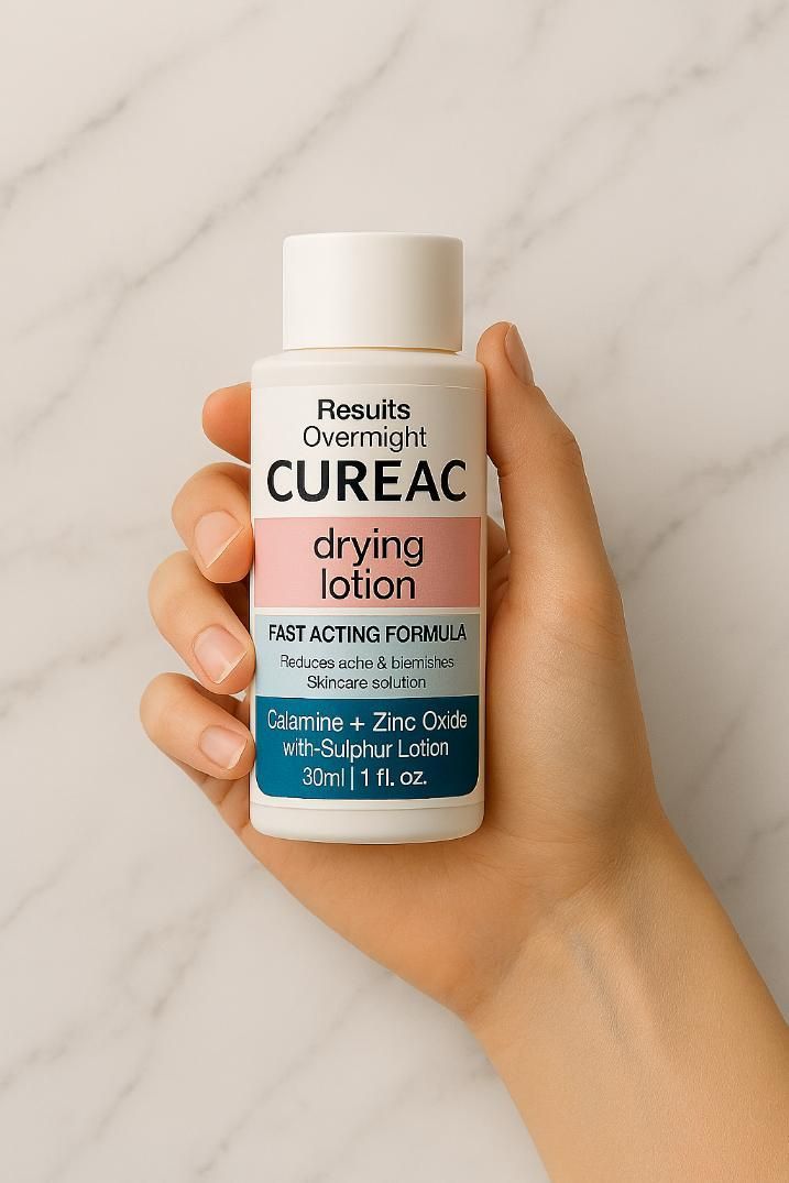 Drying Lotion With Calamine, Zinc Oxide & Sulphur - 30ml Each (Pack of 2)